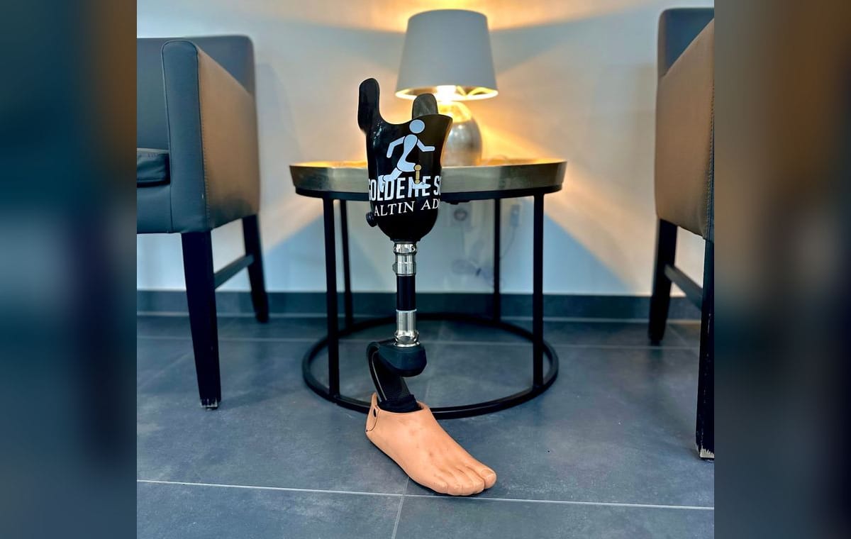 Beinprothese mit dem Logo von Goldene Schritte e.V.